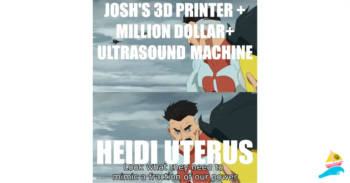 Josh's 3d printer + million dollar+ ultrasound machine
